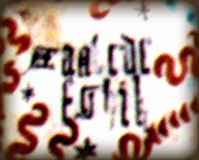 sjogres1.jpg
